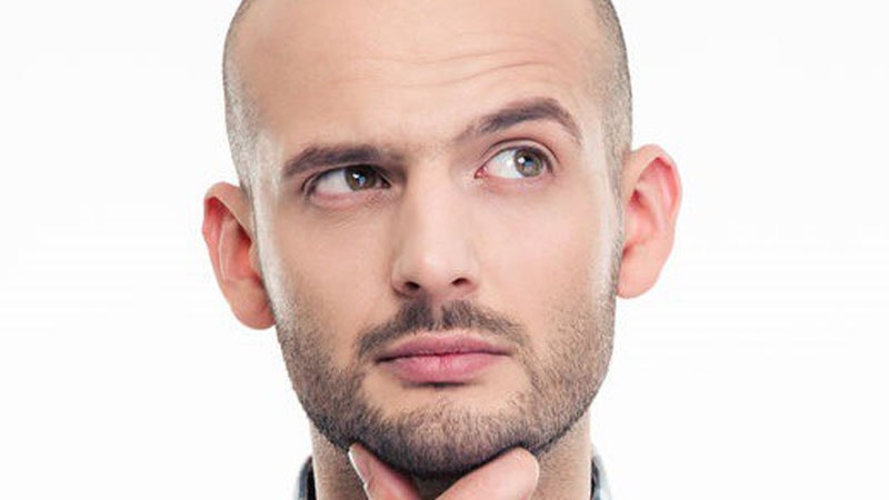 آیا نتیجه ی کاشت مو در همه ی افراد یکسان است؟ آیا نتیجه ی کاشت مو در همه ی افراد یکسان است؟