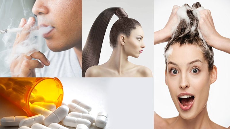 شایع ترین دلیل کاهش موی جلو سر کدام است شایع ترین دلیل کاهش موی جلو سر کدام است