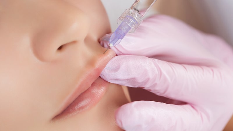 آیا تزریق ژل و فیلر مطمئن و امن است آیا تزریق ژل و فیلر مطمئن و امن است