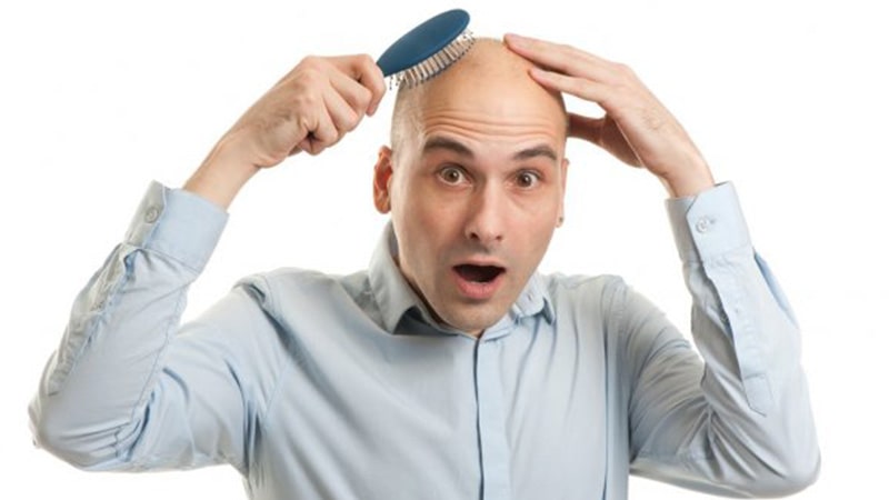 آیا ریزش مو بعد از کاشت طبیعی است؟ آیا ریزش مو بعد از کاشت طبیعی است؟
